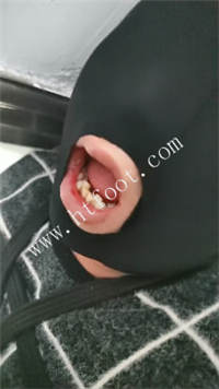 121324b3z29fy31pyp2zrv.jpg